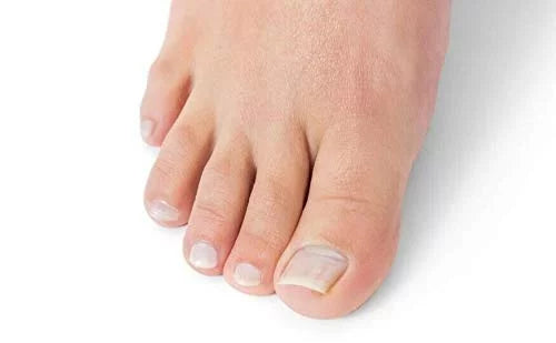Oriundo Life Nail Treatment, Tratamiento Para Uñas, Extra Sizetrength Nail Renewal, Made in USizeA